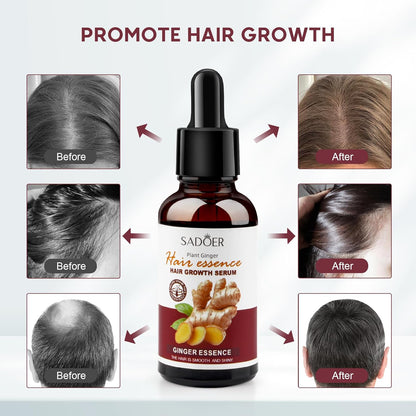 Huile essentielle de gingembre pour cheveux